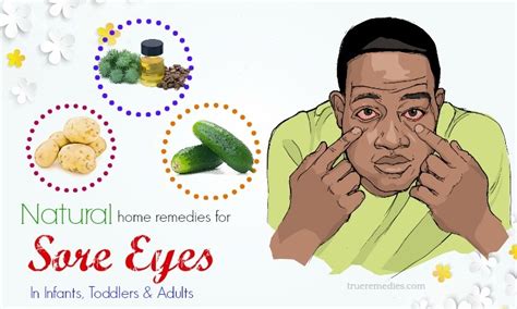 19 Home Remedies For Sore Eyes In Infants Toddlers And Adults