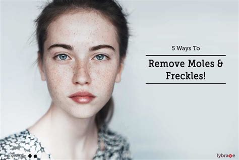 5 ways to remove moles and freckles by dr anshuman manaswi lybrate