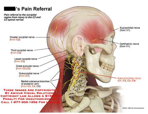 Pain Referral To Occipital Region From C2 And C3 Spinal Nerves Nerve