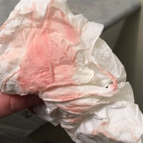 Light Pink Blood When I Wipe