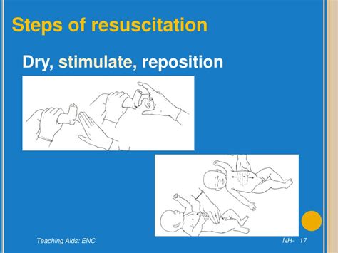 Ppt Resuscitation Of The Newborn Baby Powerpoint Presentation Free