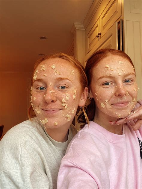 Honey Face Mask Before And After Vlr Eng Br
