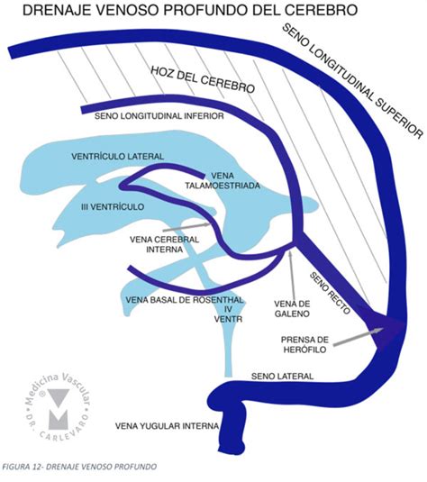 A rich vein of coal; Anatomía cerebral - Medicina Vascular