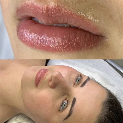 Cosmetic Lip Blush NSW | Lip Tattoo Specialist - My Rejuvenate