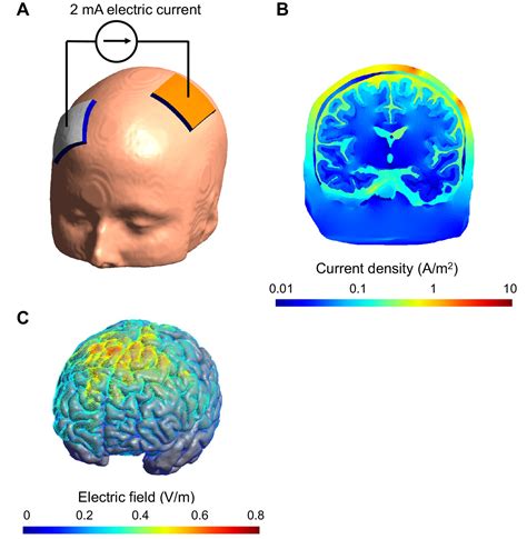 Neuromodulation Transcranial Electric Stimulation Seen From Within The