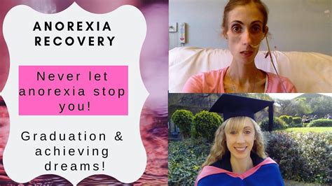 Anorexia Recovery Graduation And Achieving Your Dreams Dont Let