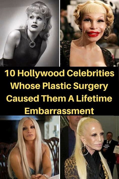 Plastic Surgery Before And After Pictures Of Hollywood Celebrities Who