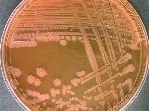 Proteus Vulgaris Colony Morphology On Nutrient Agar Nutrienkarbo