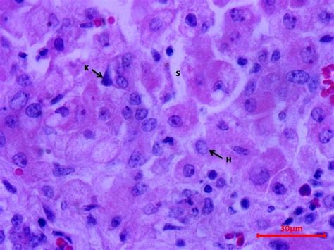 Parenchyma Of Liver Showing H Hepatocytes S Sinusoids K Kupffers