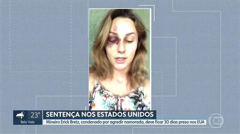 Mineira Vítima De Agressão Nos Eua Fala Sobre Prisão Do Ex Namorado