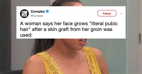 Botched Surgery Causes Pubic Hair To Grow On Womans Face
