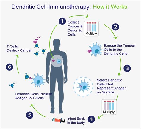 Stem Cell Treatment For Cancer In Mexico Dendritic Cells Immunotherapy