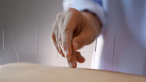 Does Acupuncture Help With Anxiety Problems