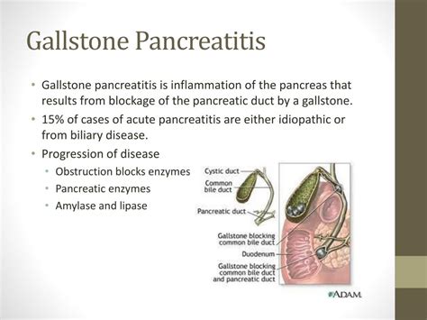 Ppt Clinical Case Study Acute Pancreatitis Powerpoint Presentation