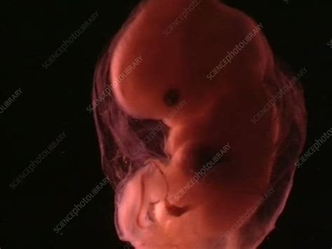 Human Embryo 8 Weeks Stock Video Clip K0052397 Science Photo