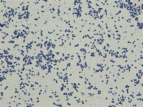 Gram Staining Of Mucoid Rhodococcus Equi Colonies Amplification