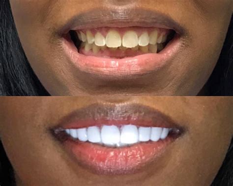 Smiles - Smiles by Dr. Price