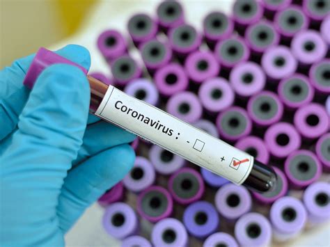Scientists test a new vaccine on cells and then give it to animals such as mice or monkeys to see if it produces an immune response. Hong Kong researchers develop coronavirus vaccine | 2020 ...