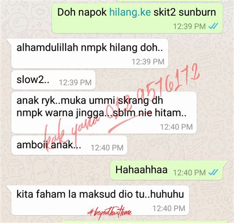 It damages your skin and is a leading cause of skin sunburn is bad news, but the good news is that it's totally preventable. Cara Hilangkan Sunburn Bagi Orang Kuat Main Sukan ...