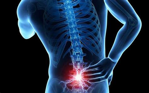 75% kes sakit belakang tidak dapat dipastikan punca sebenarnya. Obat alami sakit tulang belakang // walatra samulinpro