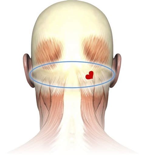 Areas Of The Back Of The Head Orthopedic Spinal Surgery And