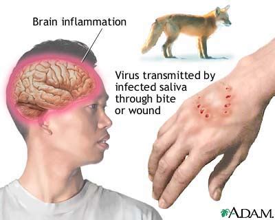 It is mainly a disease of animals, but humans can get rabies when animals infected with the disease bite them. Rabies Symptoms, Diagnostic and Prevention | Nanda Books