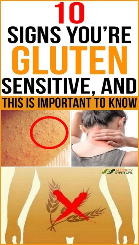 10 Signs Youre Gluten Sensitive And This Is Important To Know Medicine Health Life