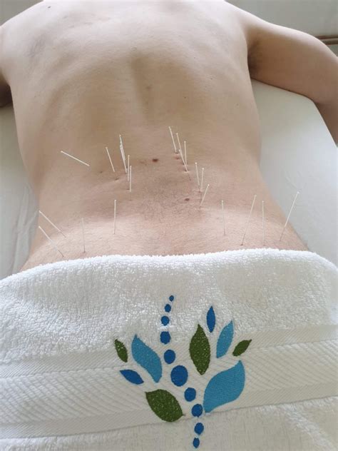 Ekscentrične vježbe za teniski lakat mp3 duration 1:41 size 3.85 mb / specijalna bolnica akromion 4. Fiziocentar Pro Spine: Što je to Dry Needling tehnika?