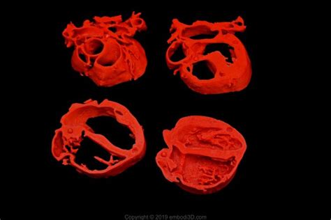 3d Printable Human Heart Model Improved With Stackable Slices Stl