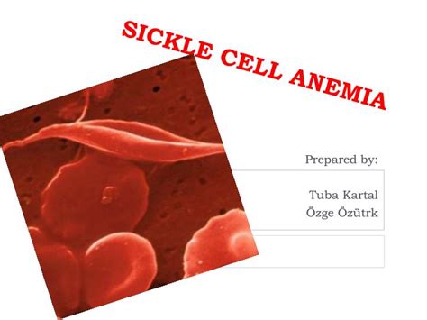 PPT - SICKLE CELL ANEMIA PowerPoint Presentation, free ...