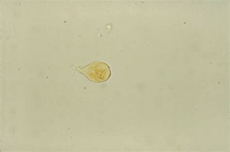 giardia lamblia cyst under microscope micropedia 60720 hot sex picture