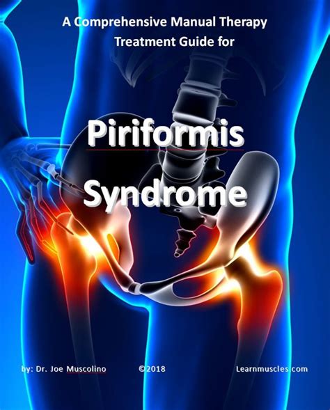 A Comprehensive Treatment Guide For Piriformis Syndrome Learn Muscles