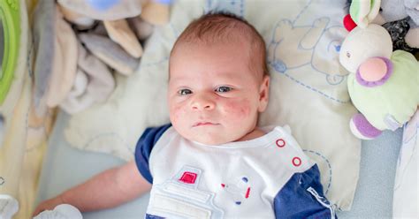 Maybe you would like to learn more about one of these? Viral Rashes in Babies: Types, Pictures, Diagnosis, Treatment