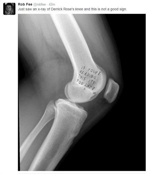 At the point that xray is sanitizing the html value, the microformats parser has already converted the html to plaintext. X-ray of Derrick Rose's Knee : BlackPeopleTwitter