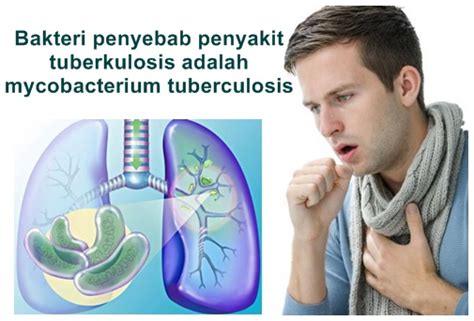 A microbial biorealm page on the genus mycobacterium tuberculosis. Cara Mengobati Penyakit Tuberkulosis Yang Aman Dan Alami ...