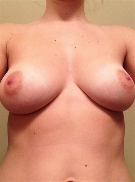 Beautiful Speckled Boobs Porn Pic Eporner