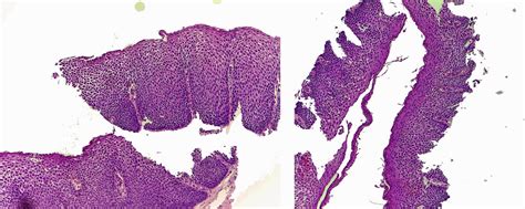 Gastrointestinal And Liver Histology Pathology Atlas Esophagus