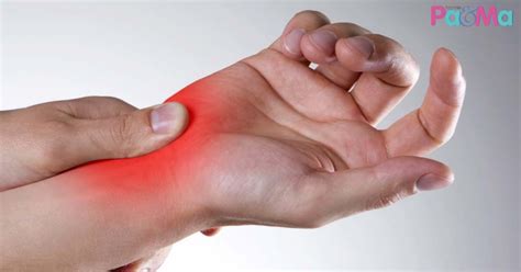 Pengobatan gangguan kebas tangan/kaki/jari tubuh manusia terdiri dari jaringan saraf yang rumit. Ibu Hamil Mudah Terkena Carpal Tunnel Syndrome. Kebas ...