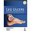 Leg Ulcers Diagnosis And Management Buy 