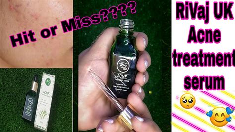 Rivaj uk Acne treatment Serum Review/ oily skin serum/ Hit or Miss