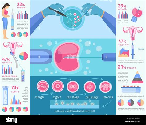 In Vitro Fertilization Flat Infographic Template With Diagrams Charts