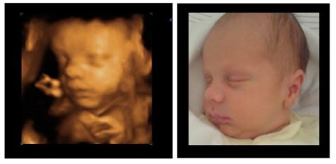 All You Need To Know About 3d4d Baby Scans Including Where To Find