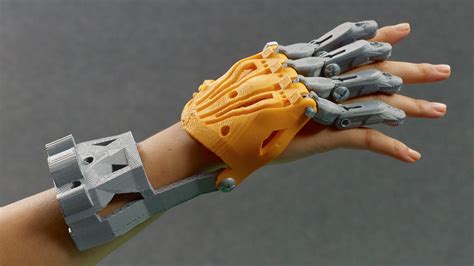 Customized Hand Prosthetic Image Source