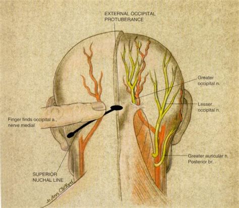 Greater Occipital Nerve Location Occipital Nerve Block Relaxing