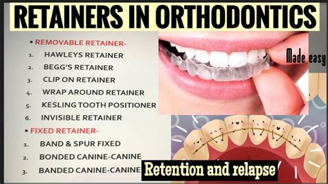 Retainers In Orthodontics Ii Removable And Fixed Ii Retention And