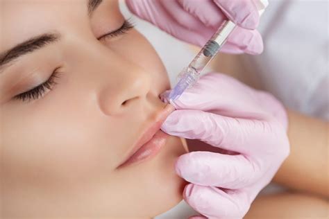 Interested In The Botox Lip Flip Here Are Things You Need To Know Kalos Medical Spa