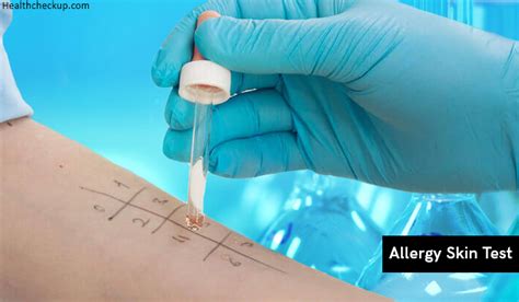 That said, blood test results tend to be somewhat more. Allergy Skin Test Results Interpretation, Side Effects ...