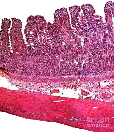Small Intestine Photograph By Dr Keith Wheeler Science Photo Library
