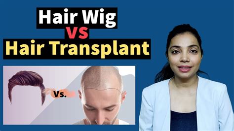 Hair Wig Vs Hair Transplant Whats The Difference Between Wig And Patch Youtube