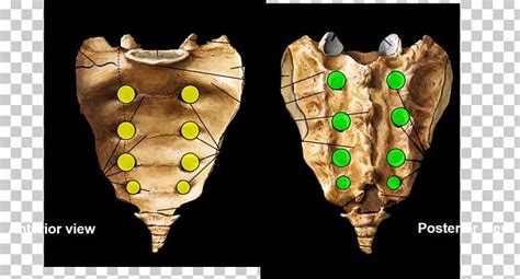 The map data is available for public download. Anatomy Mapping Foramina / Pin On Base Of Skull Foramina ...